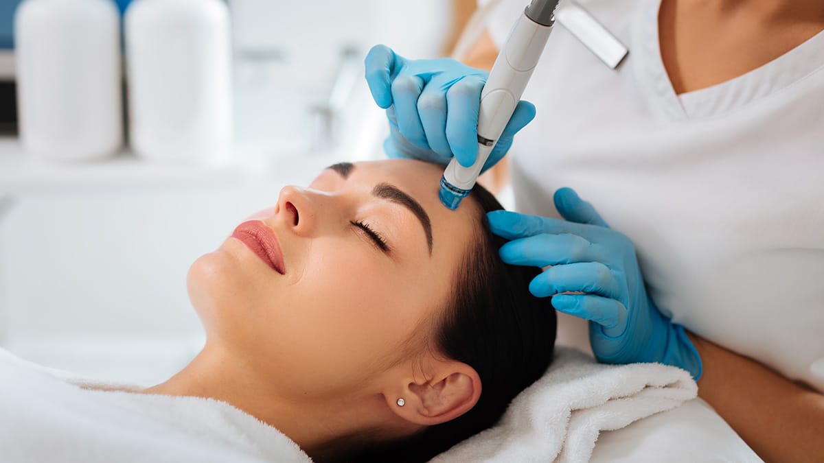 Microneedling