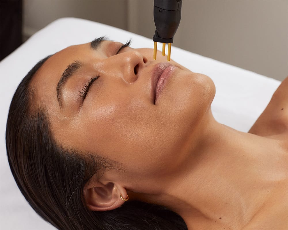 Allison-Drayton-NeoGen2-acne treatment